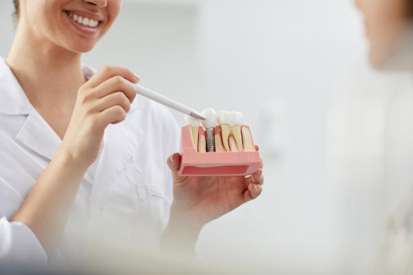 trồng răng implant giá bao nhiêu