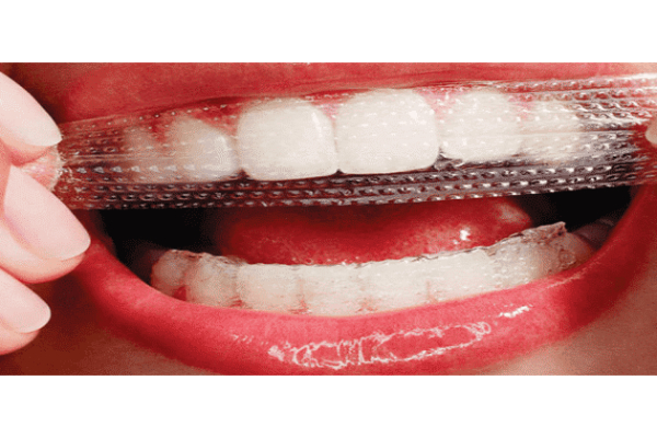 Phương pháp tẩy trắng răng tại nhà