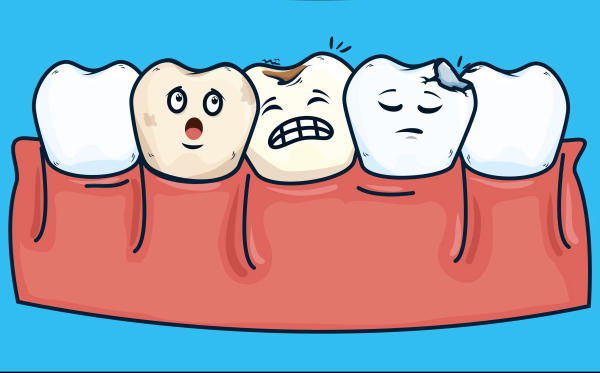 nguyên nhân gây sâu răng